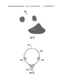 FRACTURING A SHELL OF A THREE-DIMENSIONAL OBJECT diagram and image