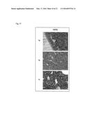 TAMOXIFEN DERIVATIVES FOR TREATMENT OF NEOPLASTIC DISEASES, ESPECIALLY     WITH HIGH HER2 PROTEIN LEVEL diagram and image