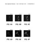 MOLECULAR TARGETS FOR ALS AND RELATED DISORDERS diagram and image