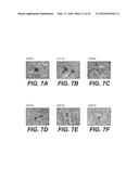 MOLECULAR TARGETS FOR ALS AND RELATED DISORDERS diagram and image