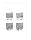 MOLECULAR TARGETS FOR ALS AND RELATED DISORDERS diagram and image