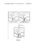 IMAGE PROCESSING DEVICE AND X-RAY DIAGNOSTIC APPARATUS diagram and image