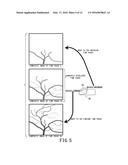 IMAGE PROCESSING DEVICE AND X-RAY DIAGNOSTIC APPARATUS diagram and image