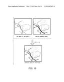 IMAGE PROCESSING DEVICE AND X-RAY DIAGNOSTIC APPARATUS diagram and image