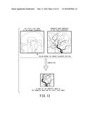 IMAGE PROCESSING DEVICE AND X-RAY DIAGNOSTIC APPARATUS diagram and image