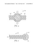 EDGE INSULATION STRUCTURE FOR ELECTRICAL CABLE diagram and image