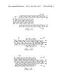 EDGE INSULATION STRUCTURE FOR ELECTRICAL CABLE diagram and image