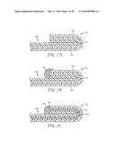 EDGE INSULATION STRUCTURE FOR ELECTRICAL CABLE diagram and image