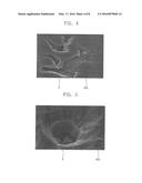 Plasma Processing Devices Having a Surface Protection Layer diagram and image