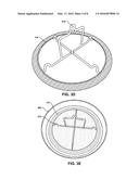 Wet Clean Process for Cleaning Plasma Processing Chamber Components diagram and image