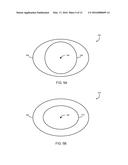 OBJECT VISUALIZATION IN BOWL-SHAPED IMAGING SYSTEMS diagram and image