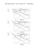 OBJECT VISUALIZATION IN BOWL-SHAPED IMAGING SYSTEMS diagram and image