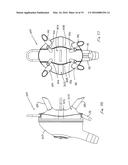 DAIRY MILKING LINER diagram and image