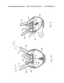 DAIRY MILKING LINER diagram and image