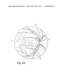 AN APPARATUS CONFIGURATED TO AND A PROCESS TO PHOTOACOUSTICALL IMAGE AND     MEASURE A STRUCTURE AT THE HUMAN EYE FUNDUS diagram and image