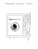 SYSTEMS AND METHODS FOR EEG MONITORING diagram and image