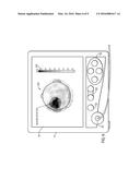 SYSTEMS AND METHODS FOR EEG MONITORING diagram and image