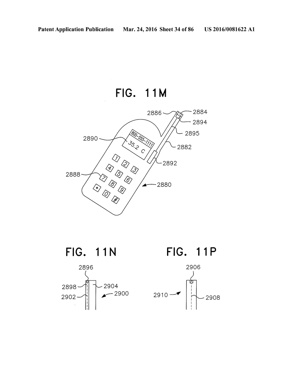 APPARATUS AND METHOD FOR MEASURING BIOLOGIC PARAMETERS - diagram, schematic, and image 35