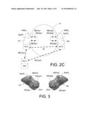 HEARING ASSISTANCE SYSTEM COMPRISING ELECTRODES FOR PICKING UP BRAIN WAVE     SIGNALS diagram and image