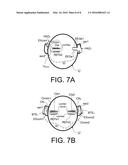 HEARING ASSISTANCE SYSTEM COMPRISING ELECTRODES FOR PICKING UP BRAIN WAVE     SIGNALS diagram and image