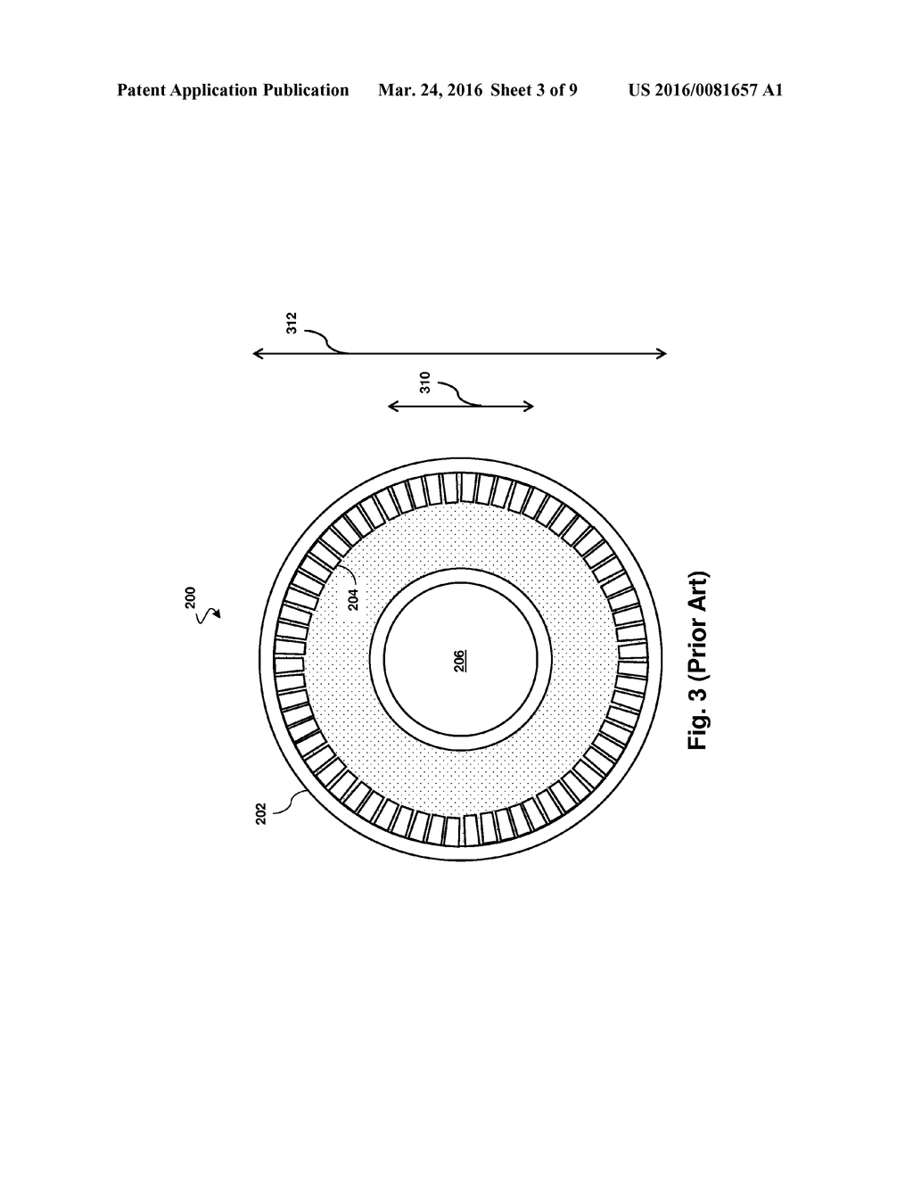 INTRAVASCULAR DEVICE FOR VESSEL MEASUREMENT AND ASSOCIATED SYSTEMS,     DEVICES, AND METHODS - diagram, schematic, and image 04