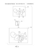 METHOD AND SYSTEM FOR REGISTERING A MEDICAL IMAGE WITH A GRAPHICAL MODEL diagram and image