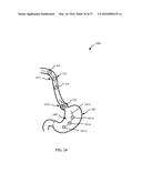 SCORED RETAINING FEATURES IN A COMPRESSIBLE CELL COLLECTION DEVICE diagram and image