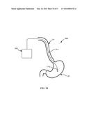 SCORED RETAINING FEATURES IN A COMPRESSIBLE CELL COLLECTION DEVICE diagram and image