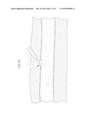 BIO-ABSORBABLE WOUND CLOSURE DEVICE AND METHOD diagram and image