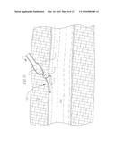 BIO-ABSORBABLE WOUND CLOSURE DEVICE AND METHOD diagram and image