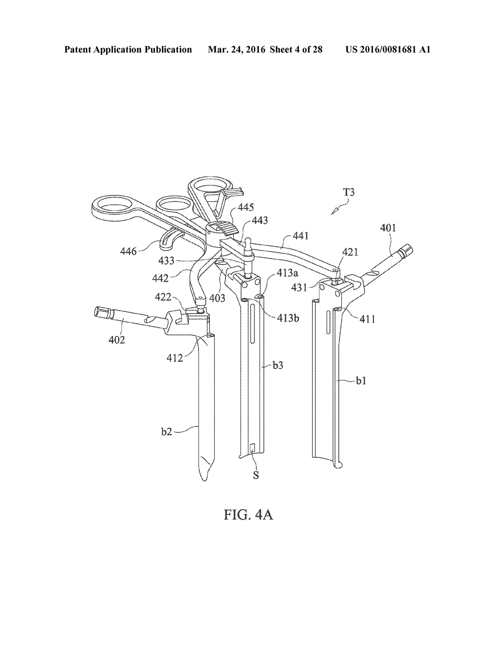 SPINAL IMPLANT SYSTEM AND METHOD FOR LUMBAR AND LUMBOSACRAL FUSION - diagram, schematic, and image 05