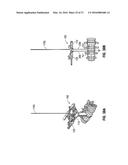 LATERAL ACCESS SYSTEM AND METHOD OF USE diagram and image