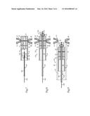 IMPLANTED MAGNETS RETRIEVAL SYSTEM AND METHOD diagram and image