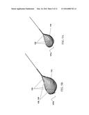 Method of Attaching A Mesh to A Coated Loop Member of A Surgical Snare     Device diagram and image