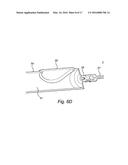 DEVICE FOR CHEMICALLY ASSISTED DISSECTION diagram and image