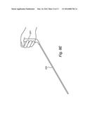 DEVICE FOR CHEMICALLY ASSISTED DISSECTION diagram and image