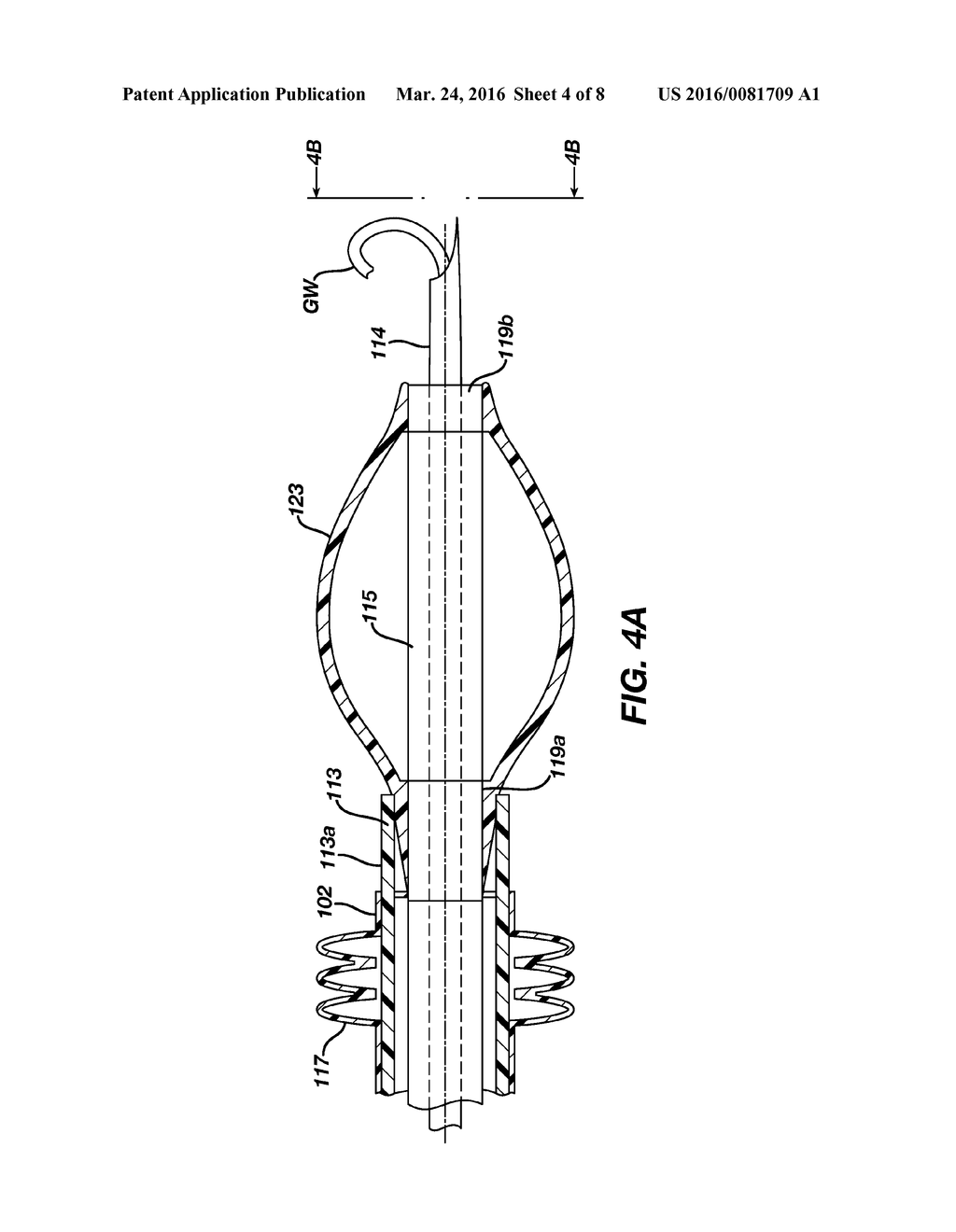 CATHETER SYSTEMS AND METHODS FOR RE-ENTRY IN BODY VESSELS WITH CHRONIC     TOTAL OCCLUSION - diagram, schematic, and image 05