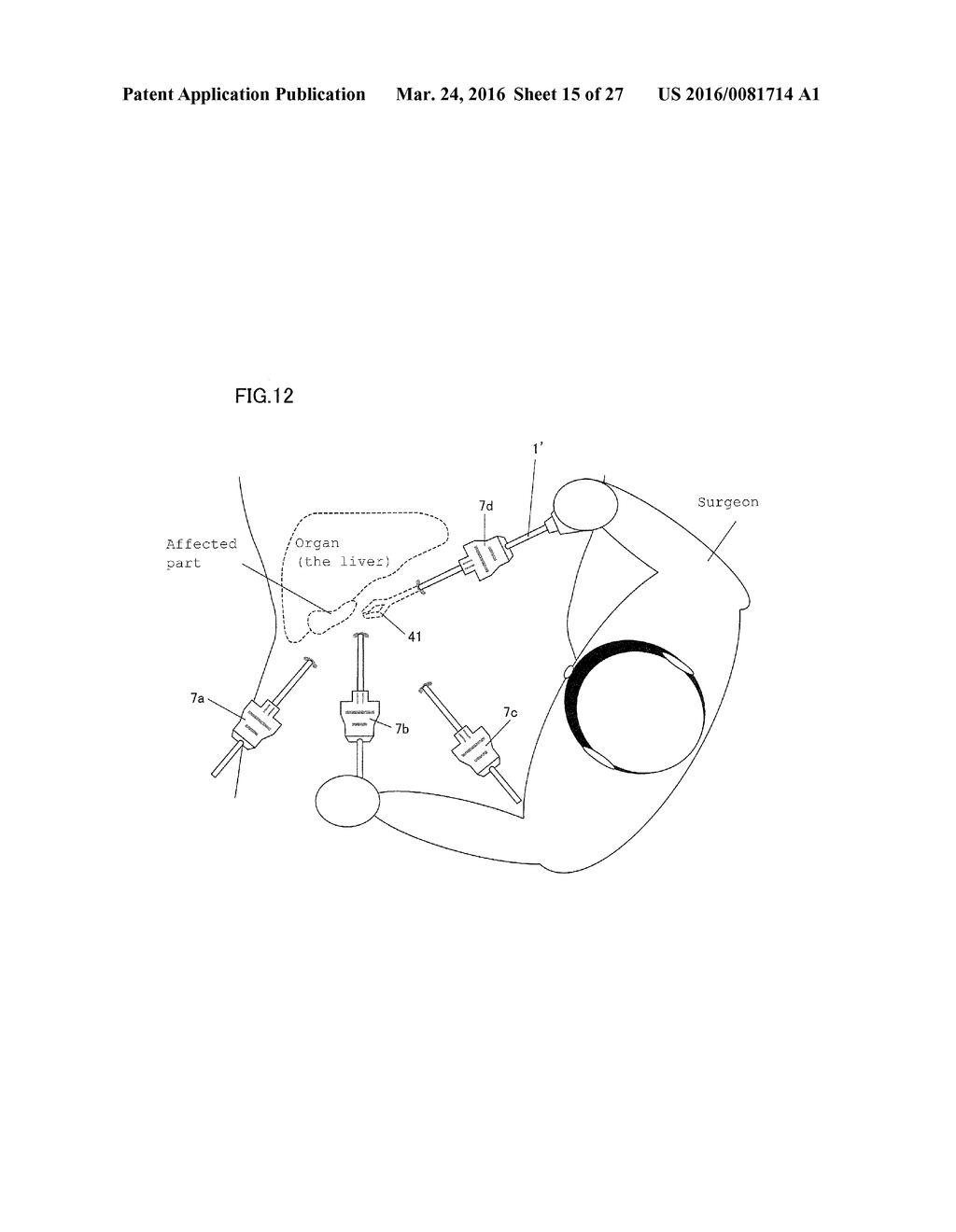 MANTLE TUBE AND TREATMENT TOOL - diagram, schematic, and image 16