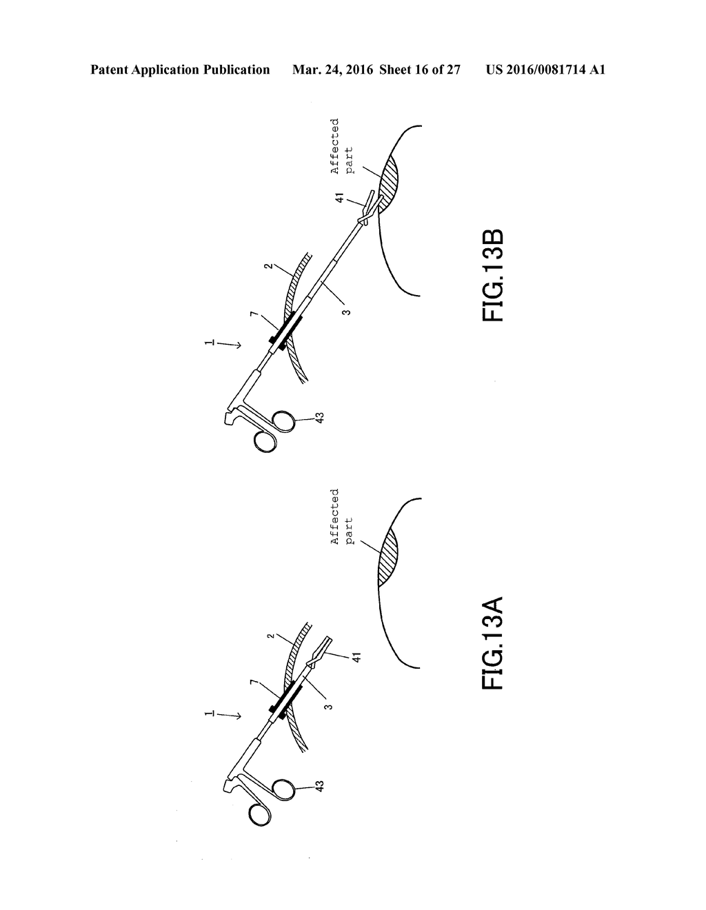 MANTLE TUBE AND TREATMENT TOOL - diagram, schematic, and image 17