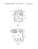 SURGICAL IMPLANT SYSTEM AND METHOD diagram and image