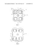 SURGICAL IMPLANT SYSTEM AND METHOD diagram and image