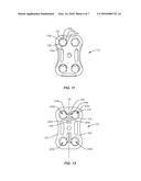 SURGICAL IMPLANT SYSTEM AND METHOD diagram and image