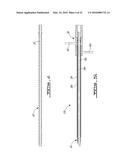 INTEGRATED CEMENT DELIVERY SYSTEM FOR BONE AUGMENTATION PROCEDURES AND     METHODS diagram and image