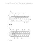 INTEGRATED CEMENT DELIVERY SYSTEM FOR BONE AUGMENTATION PROCEDURES AND     METHODS diagram and image