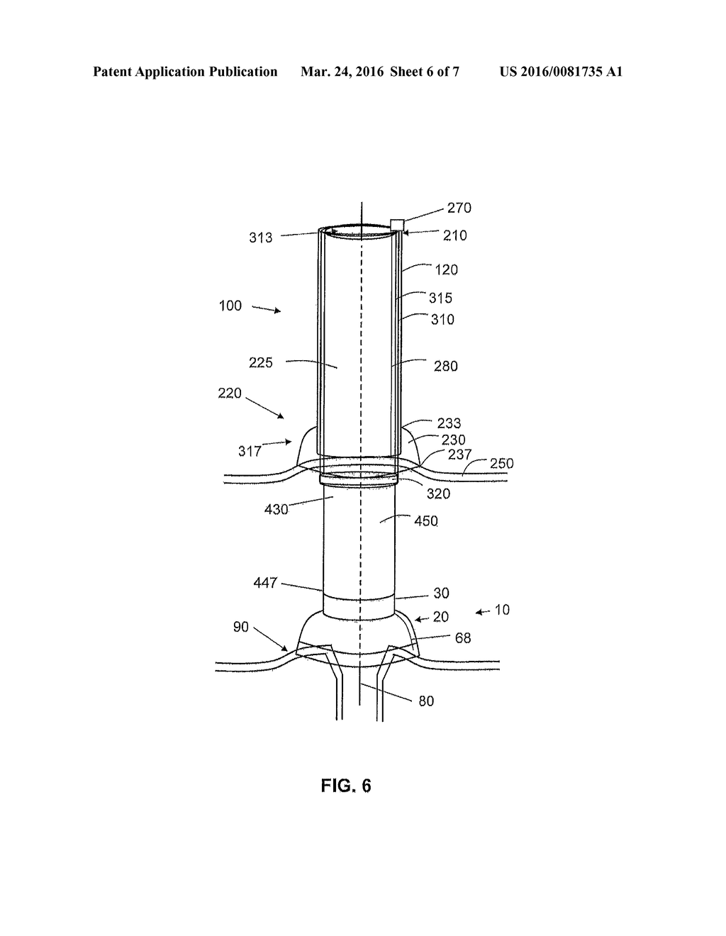 SYSTEMS AND METHODS FOR CRYOABLATION OF A TISSUE - diagram, schematic, and image 07