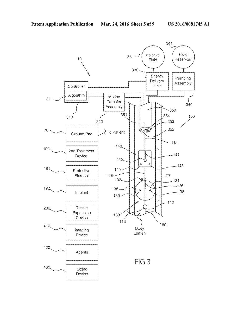 METHODS, SYSTEMS AND DEVICES FOR REDUCING THE LUMINAL SURFACE AREA OF THE     GASTROINTESTINAL TRACT - diagram, schematic, and image 06