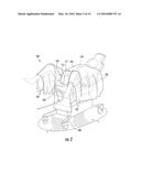 SURGICAL DRAPE FOR COLLECTING DISCHARGED FLUID diagram and image