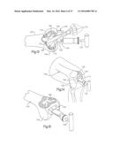 METHOD FOR PLACING IMPLANT USING ROBOTIC SYSTEM diagram and image