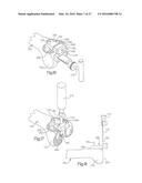 METHOD FOR PLACING IMPLANT USING ROBOTIC SYSTEM diagram and image