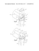 METHOD FOR PLACING IMPLANT USING ROBOTIC SYSTEM diagram and image